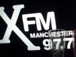 X - FM